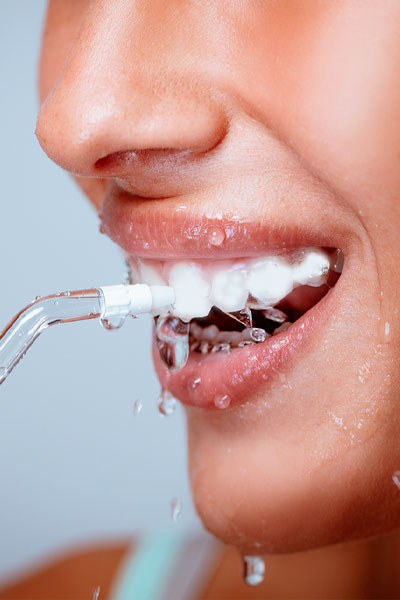 Éclaircissement dentaire