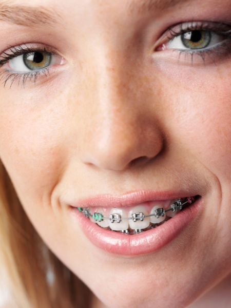 Orthodontie