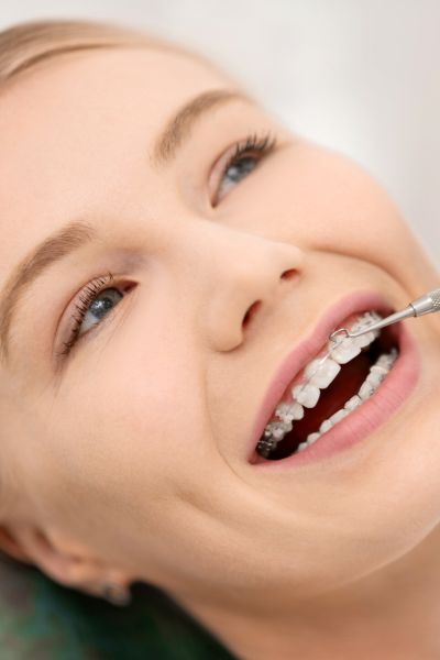 Orthodontie adulte et enfant